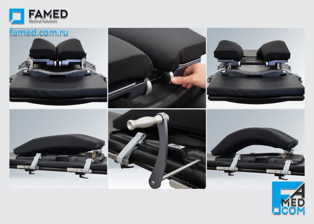 приставка для ламинэктомии (для спинальной хирургии) из карбона для визуализации C-дугой на операционном столе FAMED SU-07 с карбоновой декой